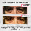 RevitalEyes® 2-in-1 Red Light Therapy