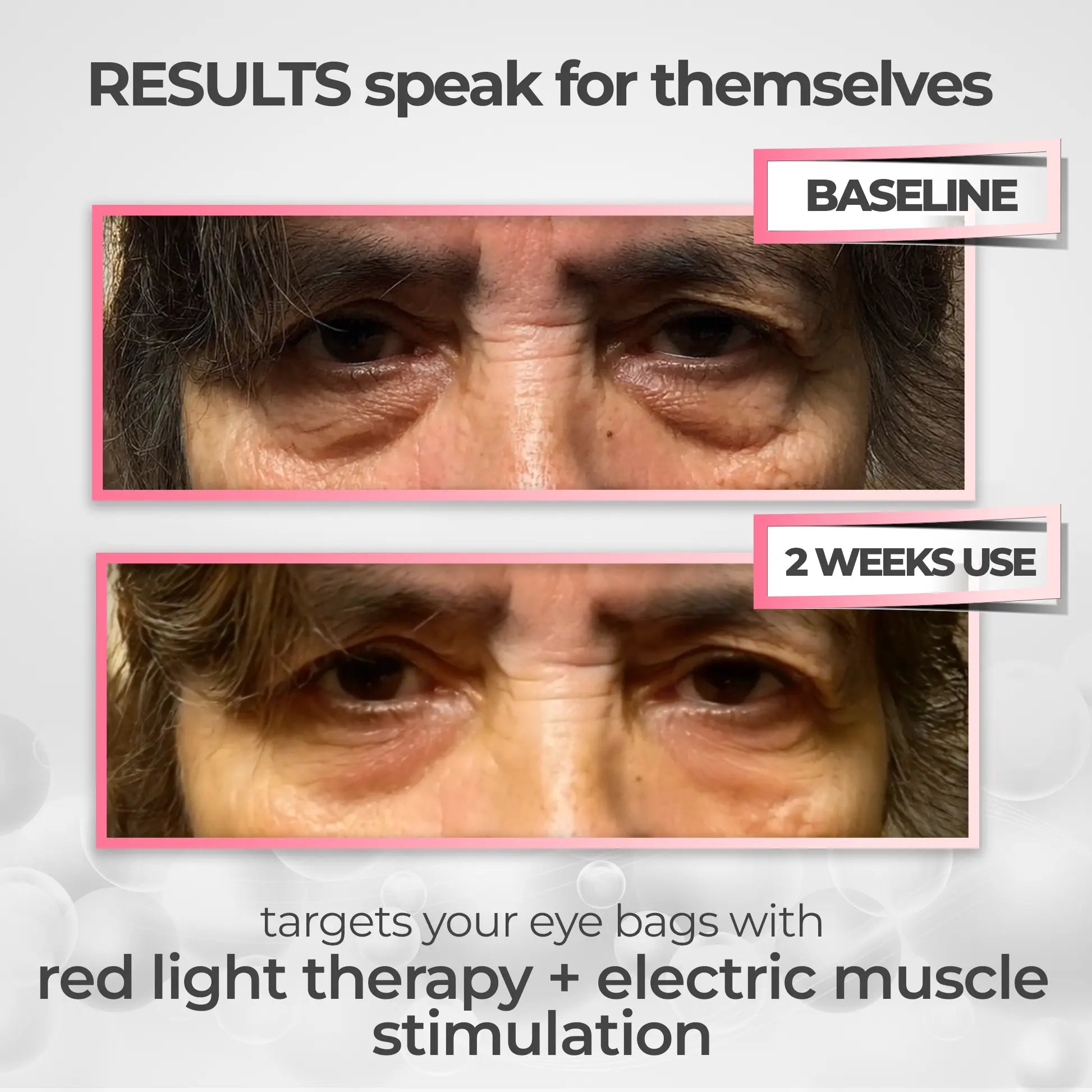 RevitalEyes® 2-in-1 Red Light Therapy