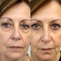 RevitalEyes® 2-in-1 Red Light Therapy