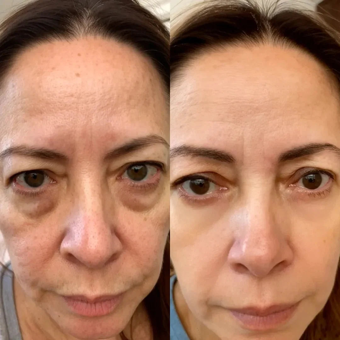 RevitalEyes® 2-in-1 Red Light Therapy