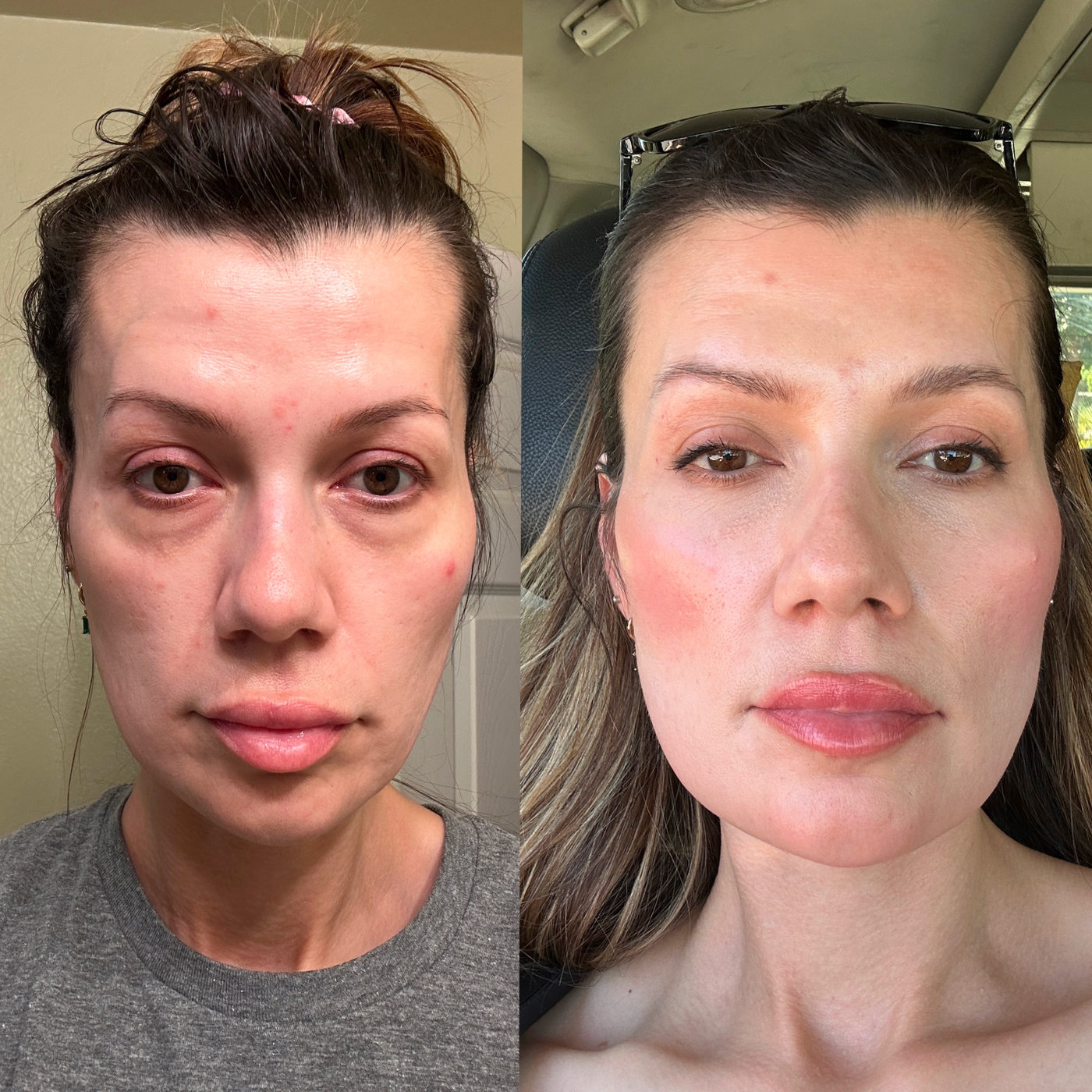 How the beauty industry profits off women's biggest insecurity