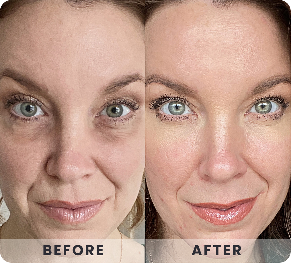 Concealer creasing into under-eye texture