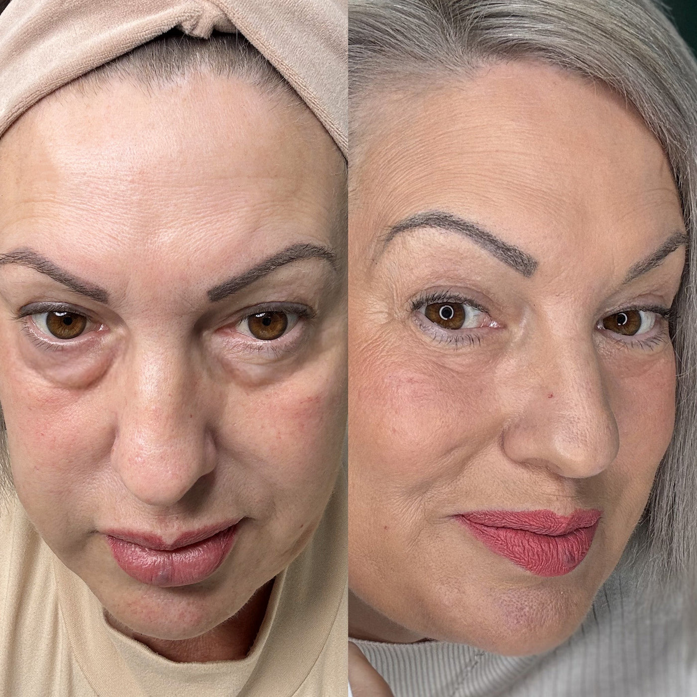 RevitalEyes prototypes